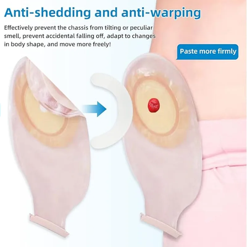 Medical Tape - Medical Ostomy Bag Reinforcement Strip Elastic