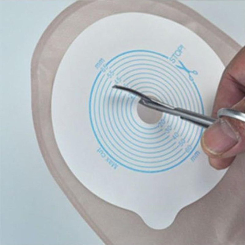 Ostomy Bags Scissors Round Hea - đánh giá và giá Medical Scissors