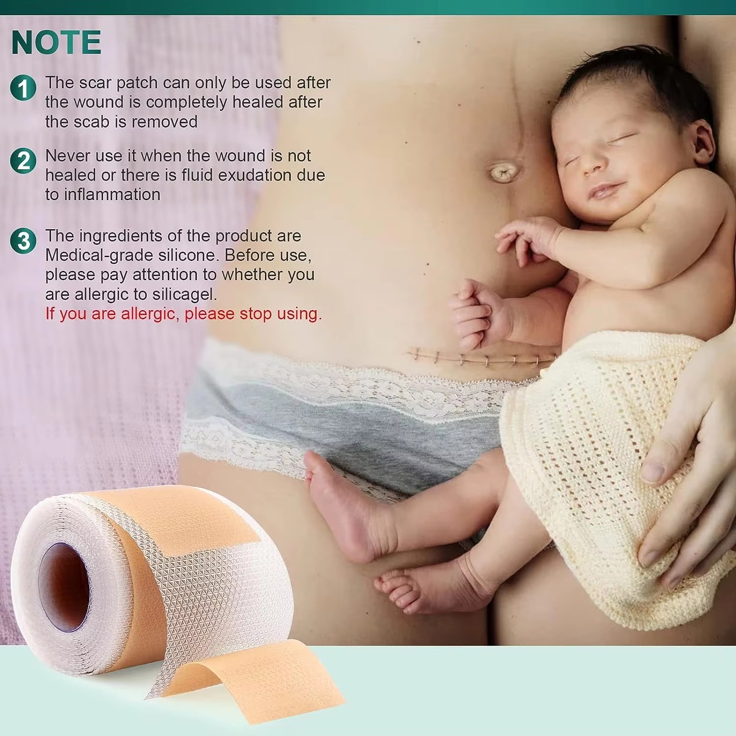 50/100/150cm Silicone Gel Scar - đánh giá và giá Medical Tape